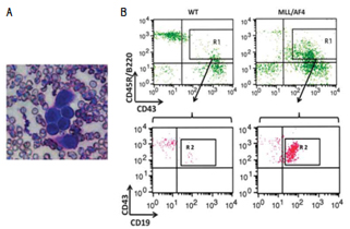 Figure 1.  Our MLL/AF4 transgenic model mice develop acute lymphoblastic leukemia (ALL) after 12 months from birth.